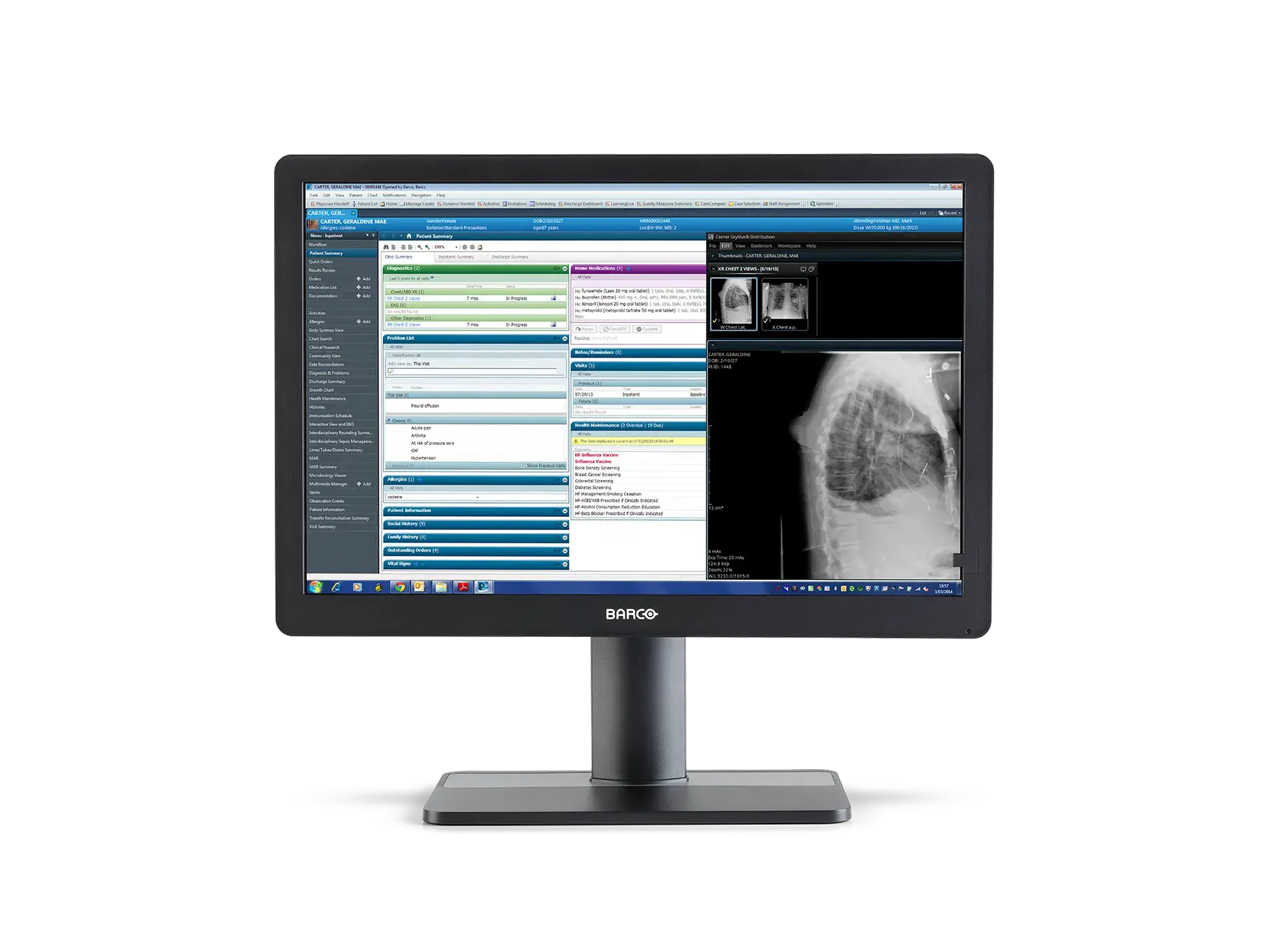 mdrc-2324-black-front-transp