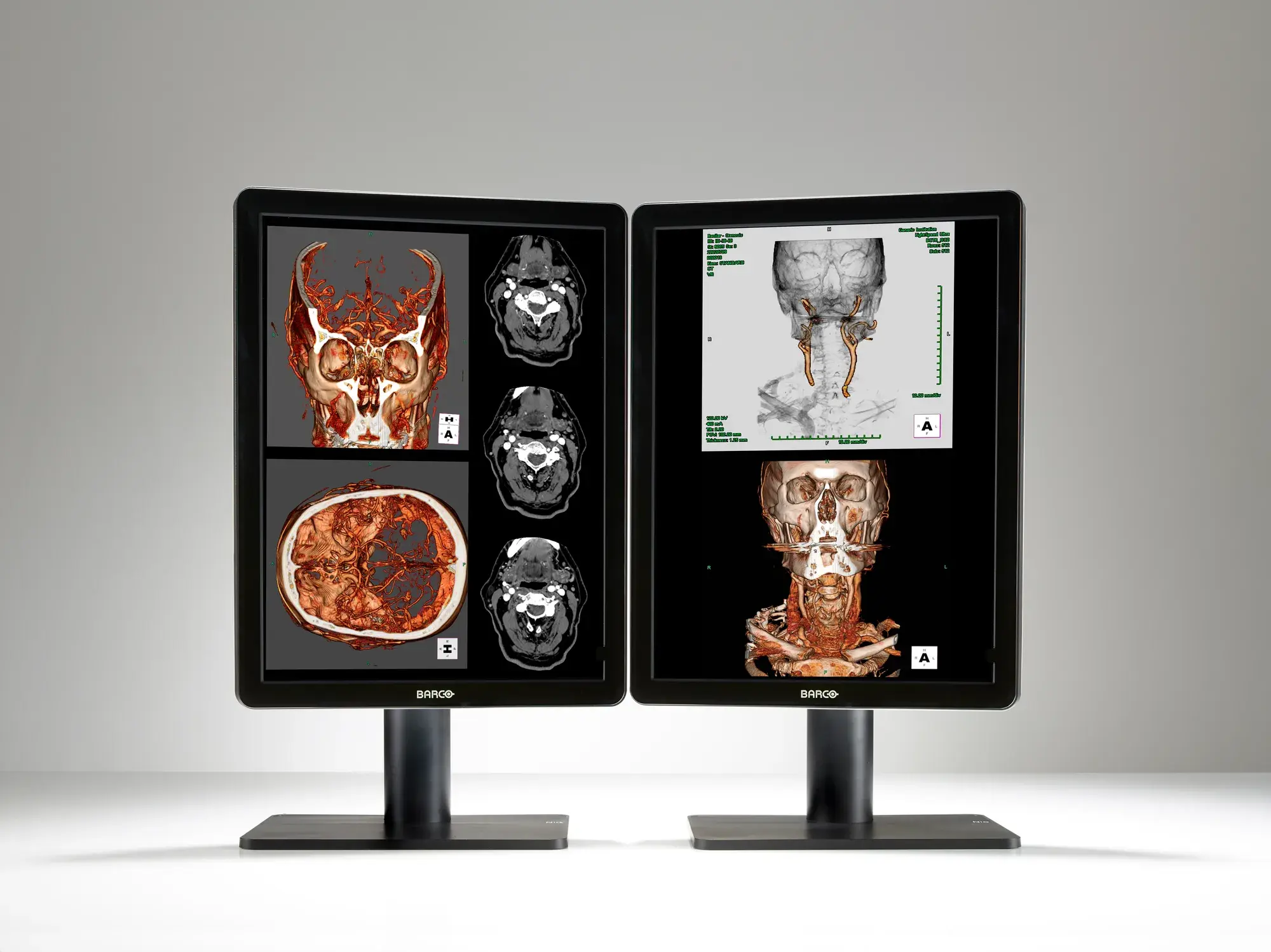 nio-color-2mp-02b-dual-head